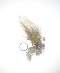 Cephaloziella spinigera