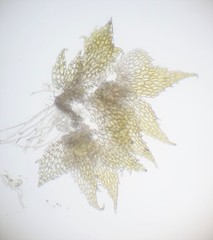Cephaloziella spinigera