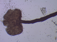 Chaenothecopsis savonica