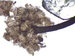 Chaenothecopsis savonica
