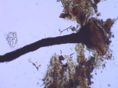 Chaenothecopsis savonica