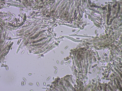 Chaenothecopsis savonica
