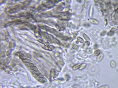 Chaenothecopsis savonica