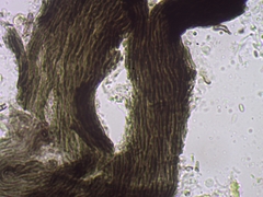 Chaenothecopsis savonica