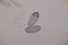 Hapalocystis