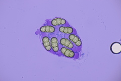 Hapalocystis berkeleyi