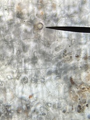 Chytridiomycota