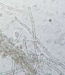 Botryobasidium conspersum