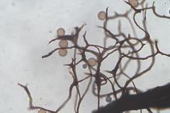 Comatricha vineatilis