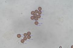 Comatricha vineatilis