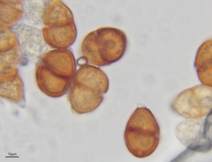 Puccinia gentianae