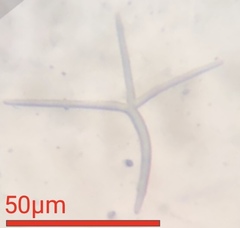 Alatospora acuminata