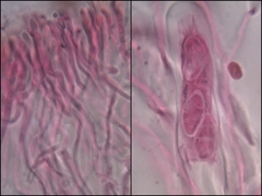 Lathagrium fuscovirens