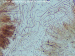 Dacrymyces corticioides