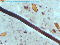 Dacrymyces corticioides