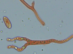 Dacrymyces corticioides