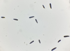 Berkleasmium concinnum