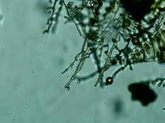 Ptychostomum imbricatulum
