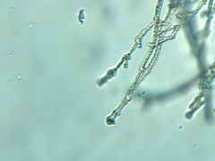 Ptychostomum imbricatulum