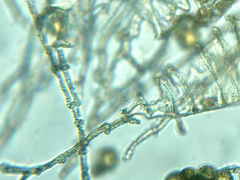 Ptychostomum imbricatulum