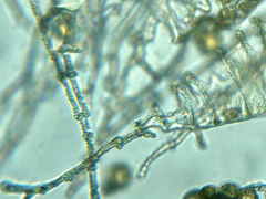 Ptychostomum imbricatulum