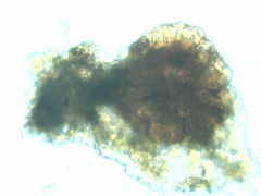 Ptychostomum imbricatulum