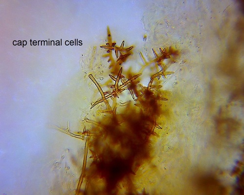 Echinochaete russiceps image