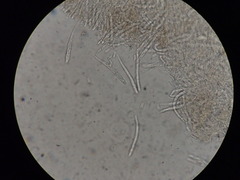 Hymenoscyphus subferrugineus