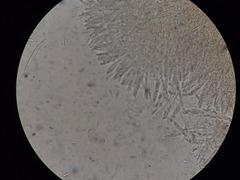 Hymenoscyphus subferrugineus