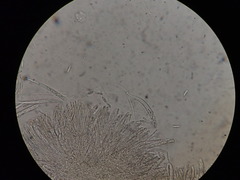 Hymenoscyphus subferrugineus