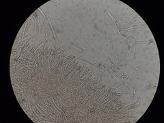 Hymenoscyphus subferrugineus