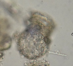 Codonella