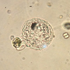 Amoebozoa