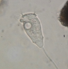 Vorticellidae