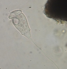 Vorticellidae