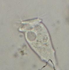 Vorticellidae