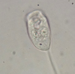 Vorticellidae