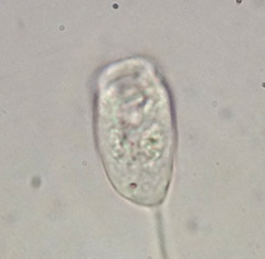 Vorticellidae