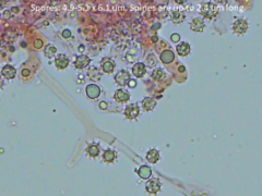 Tomentellopsis echinospora