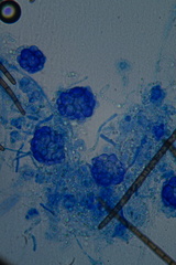 Hypomyces papulasporae