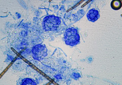 Hypomyces papulasporae