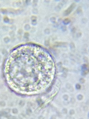 Strobilidium