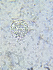 Strobilidium