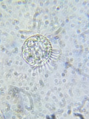 Strobilidium