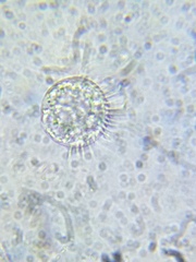 Strobilidium