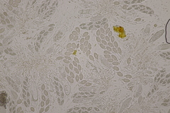 Pseudomassaria chondrospora