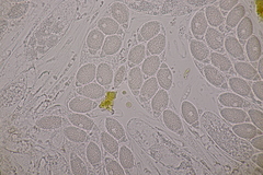 Pseudomassaria chondrospora