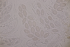 Pseudomassaria chondrospora