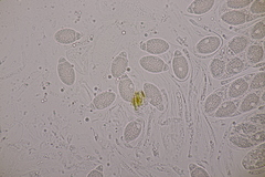 Pseudomassaria chondrospora