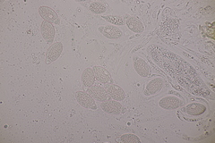 Pseudomassaria chondrospora